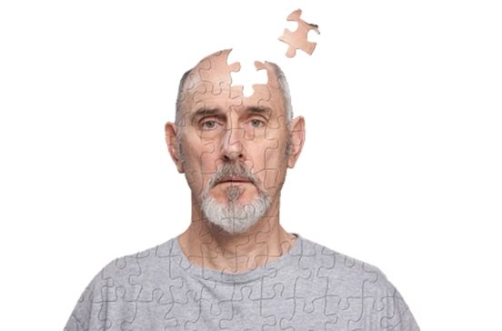 10 Things you should know about Alzheimer’s Disease – Cause, Symptoms, Stages and Treatment